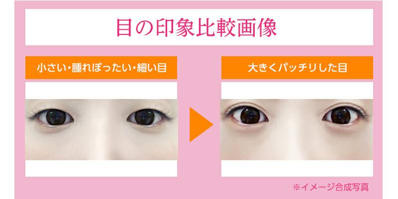 目の印象比較画像